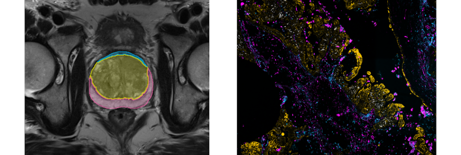 Sample images from NCI Imaging Data Common.max 1000x1000 1